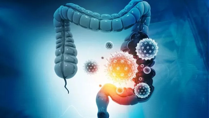 Al momento stai visualizzando Acido Butirrico: un alleato fondamentale per difendere la salute della mucosa del colon.